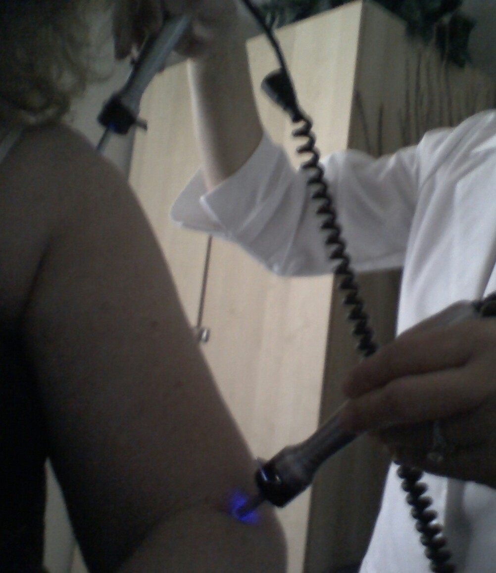 Treatment of elbow and shoulder