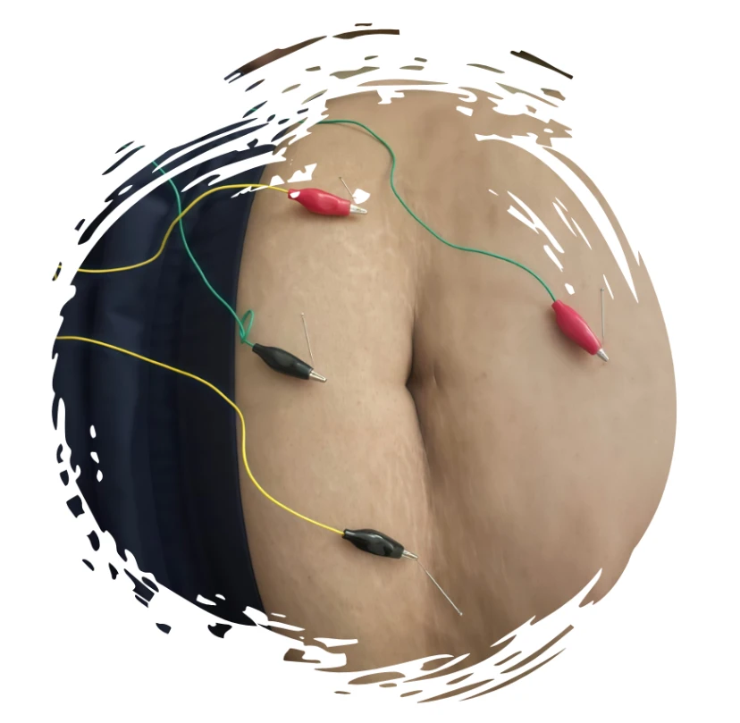 Radiant Core Ritua Acupuncture